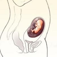 увеличение живота при беременности