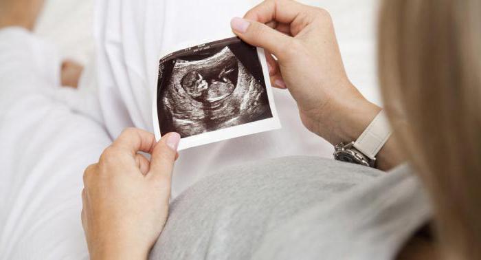 Маленький живот при беременности причины