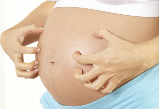 Чешется живот при беременности на поздних сроках