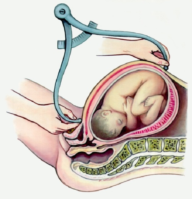 Неровный живот при беременности