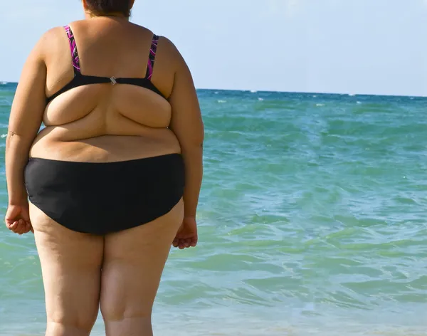 Ожирение женщин — стоковое фото