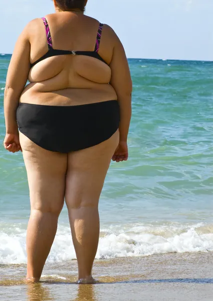 Ожирение женщин — стоковое фото